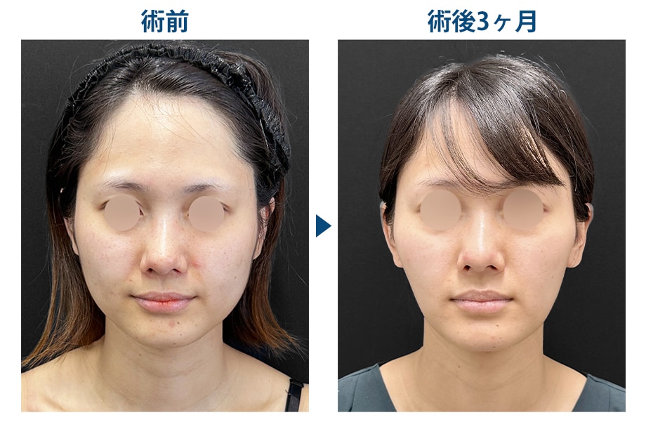 ピックアップ症例写真