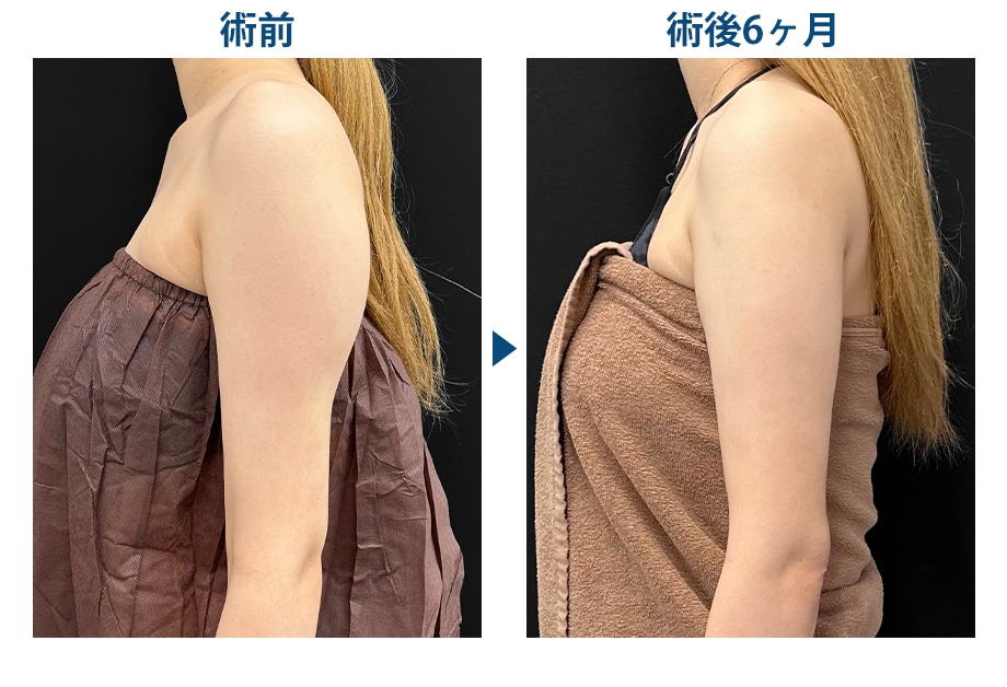 ピックアップ症例写真