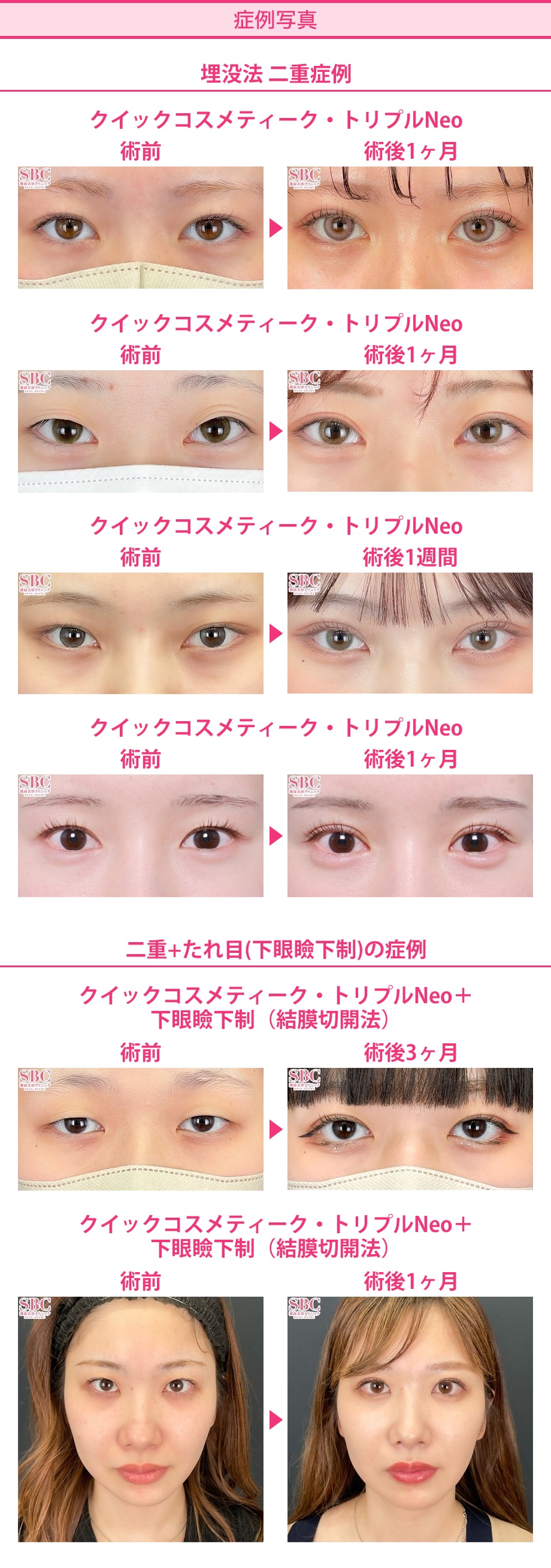 料金下症例写真