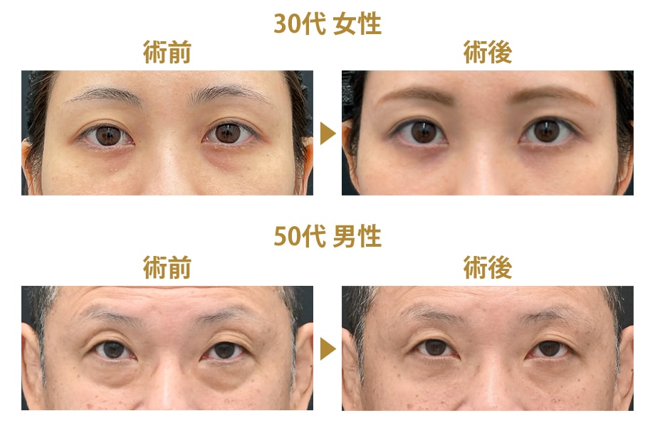 ピックアップ症例写真