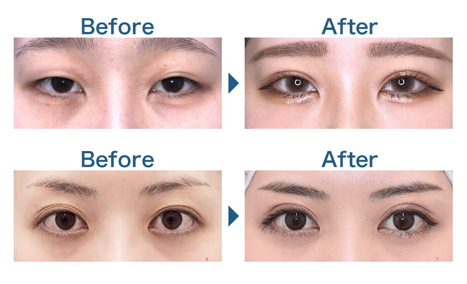before-after