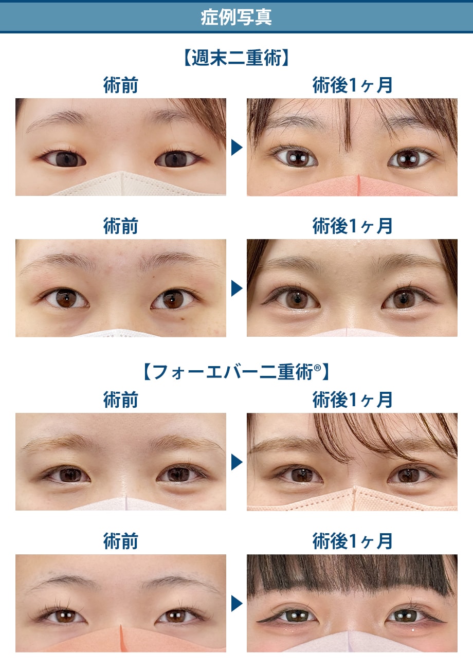 料金下症例写真