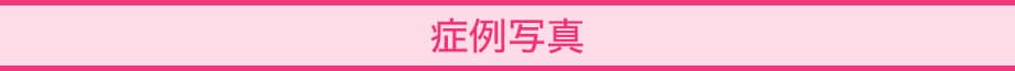 料金下症例写真