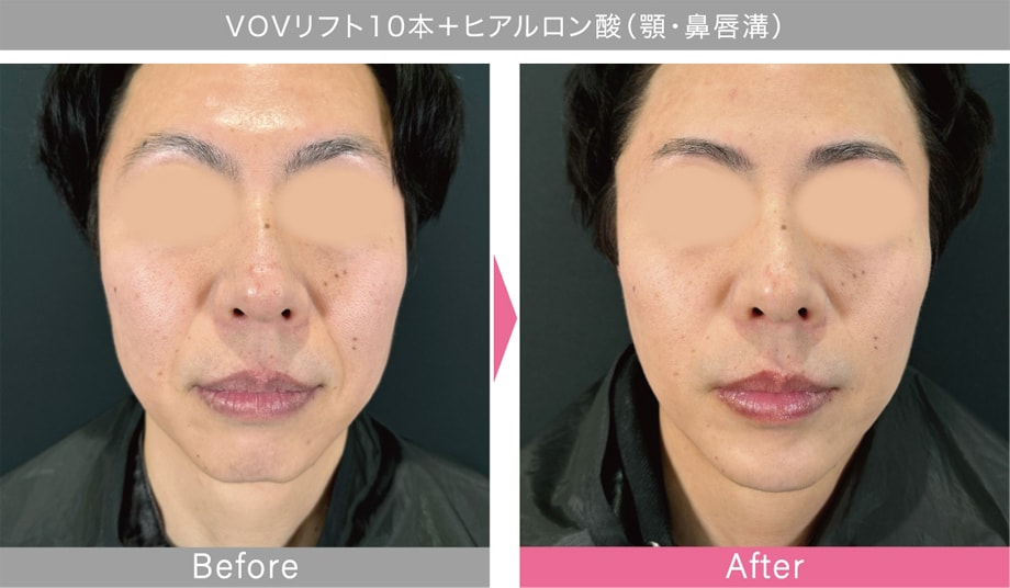症例写真