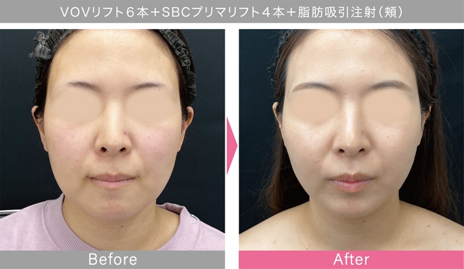 症例写真