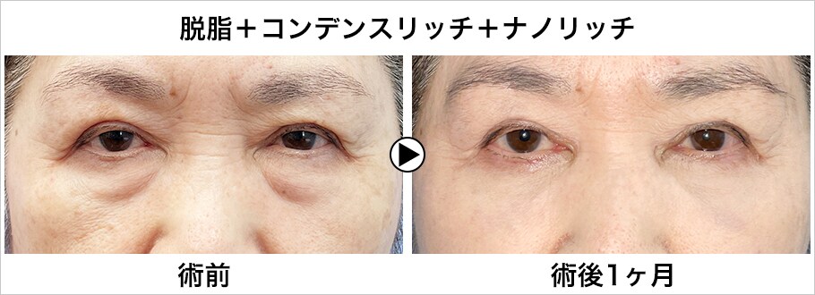 メイン下症例写真