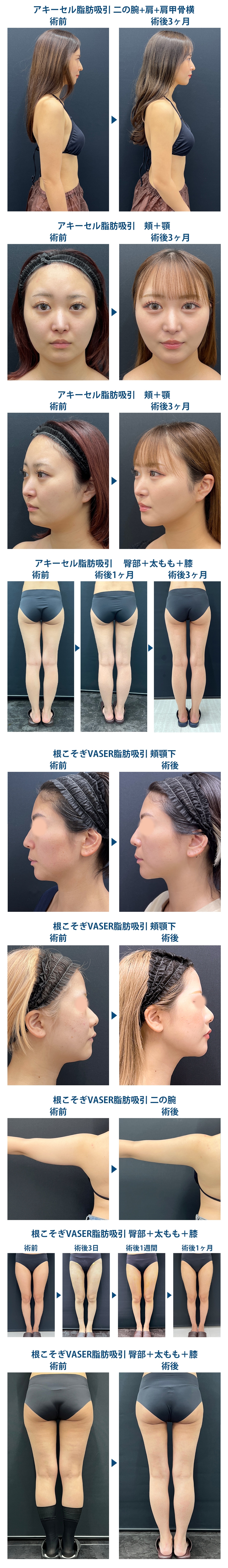 ピックアップ症例写真