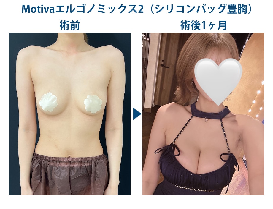料金下症例写真