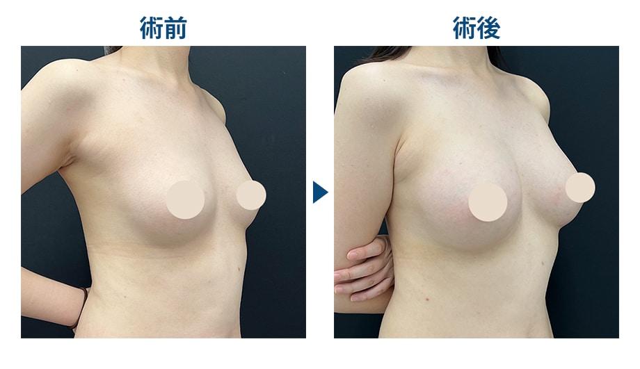 ピックアップ症例写真