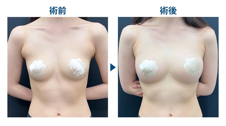 ピックアップ症例写真