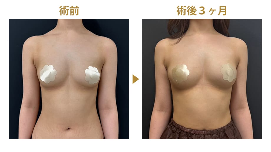 ピックアップ症例写真