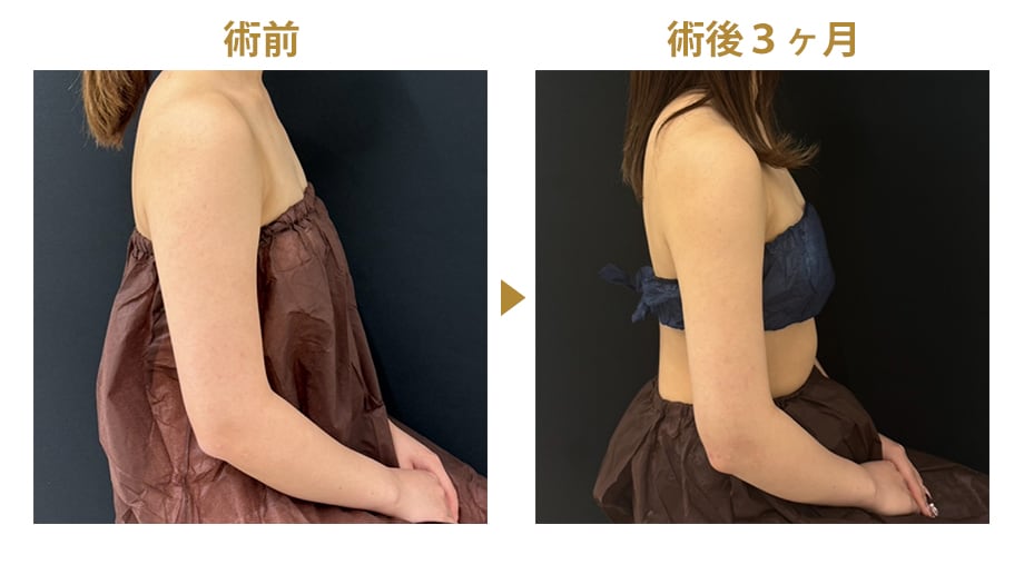 ピックアップ症例写真