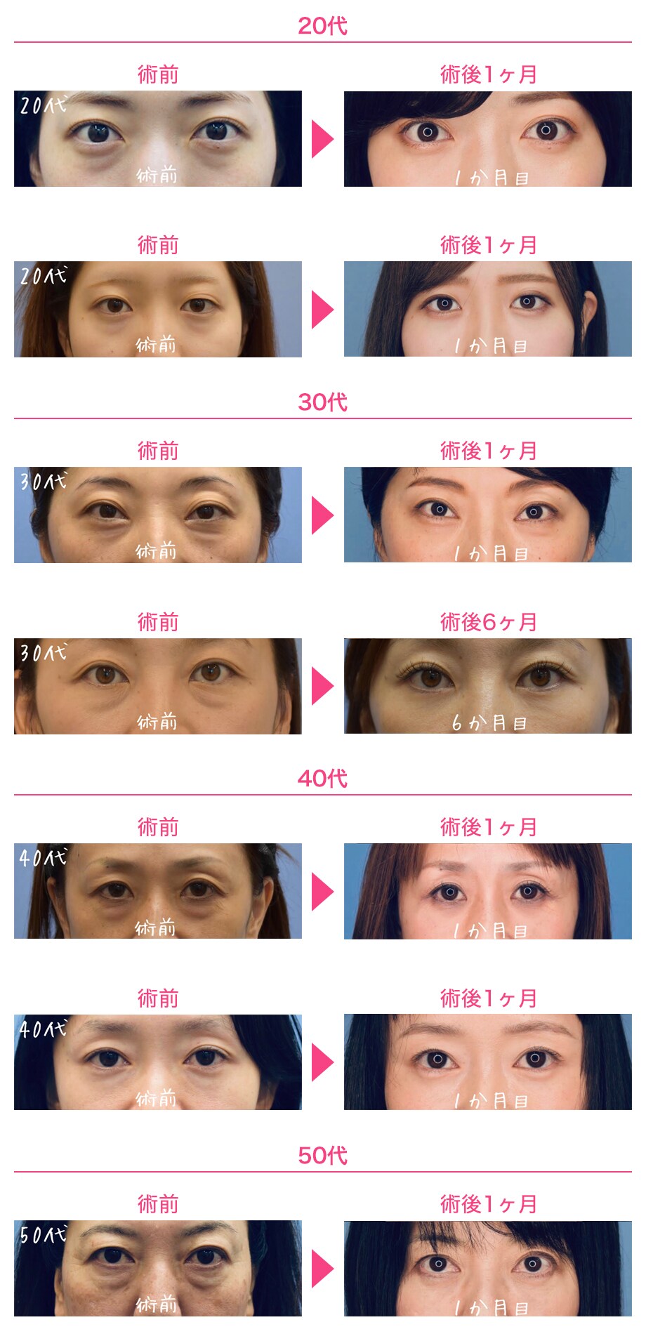 before after