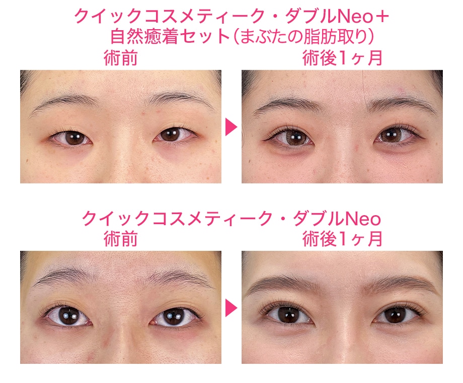 ピックアップ症例写真