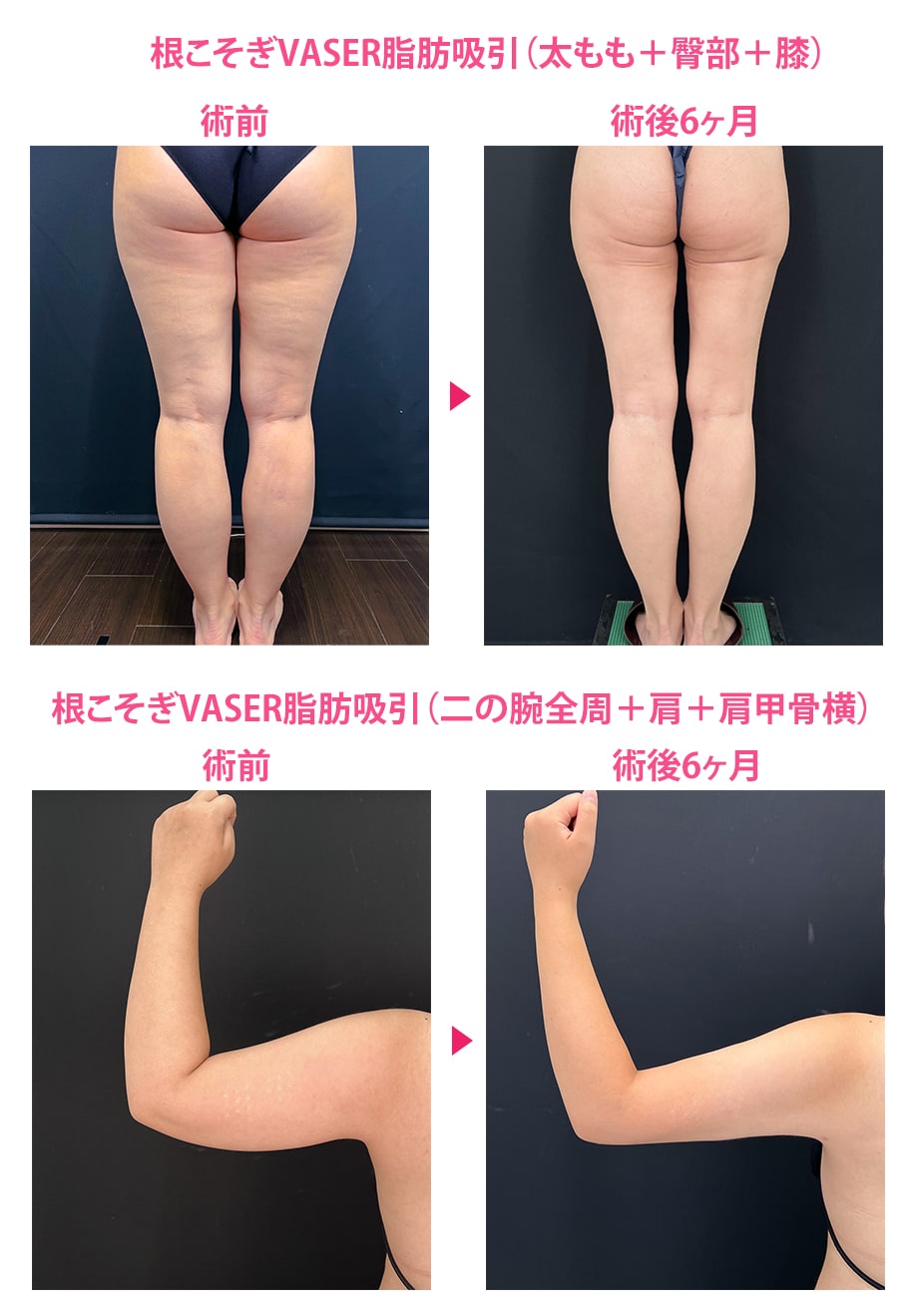 ピックアップ症例写真