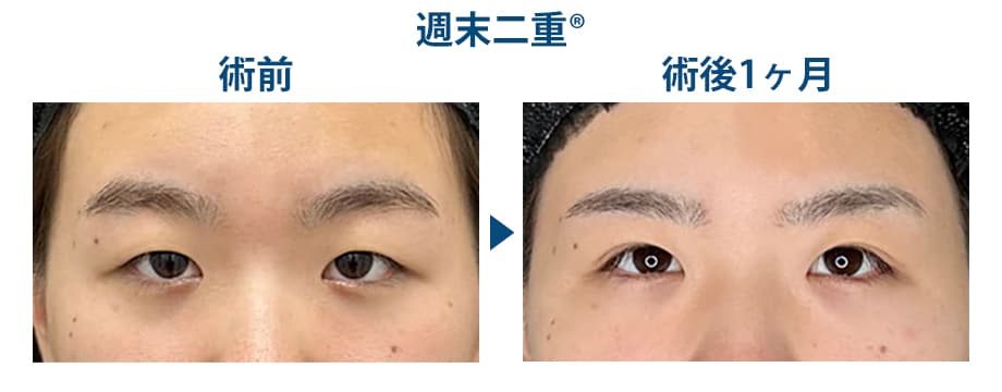 ピックアップ症例写真