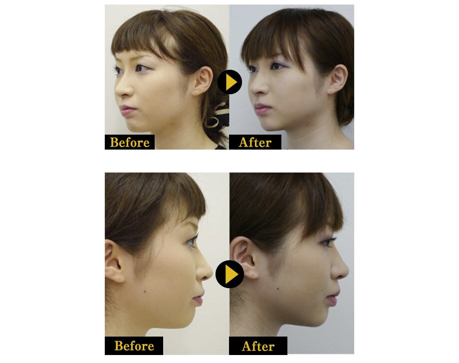 肌のアンチエイジング 若返り 美肌効果 美容皮膚科モニター募集 美容整形 美容外科の湘南美容クリニック 肌のアンチエイジング 若返り 美肌効果 美容皮膚科モニター募集 美容整形 美容外科の湘南美容クリニック