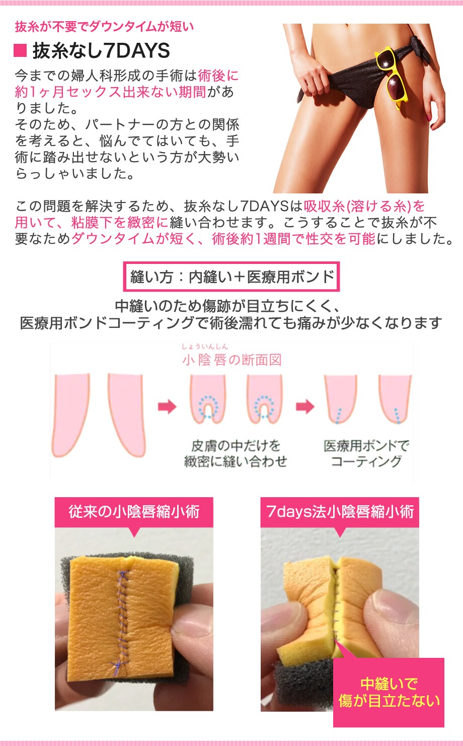 満足度オール5 連発 デリケートなお 婦人科形成モニター募集 美容整形 美容外科の湘南美容クリニック 満足度オール5 連発 デリケートなお 婦人科形成モニター募集 美容整形 美容外科の湘南美容クリニック