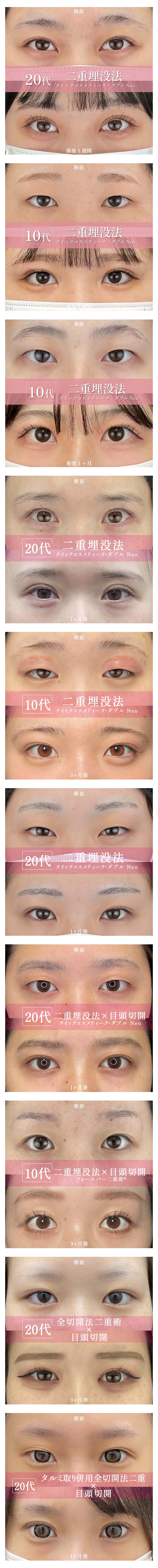 料金下症例写真