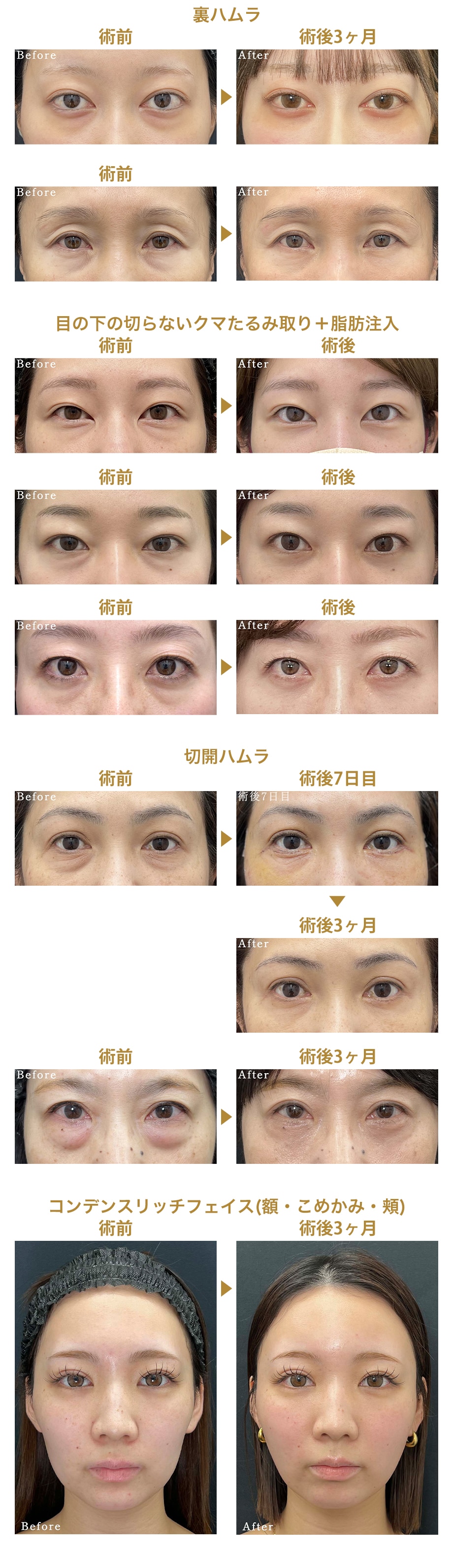 料金下症例写真