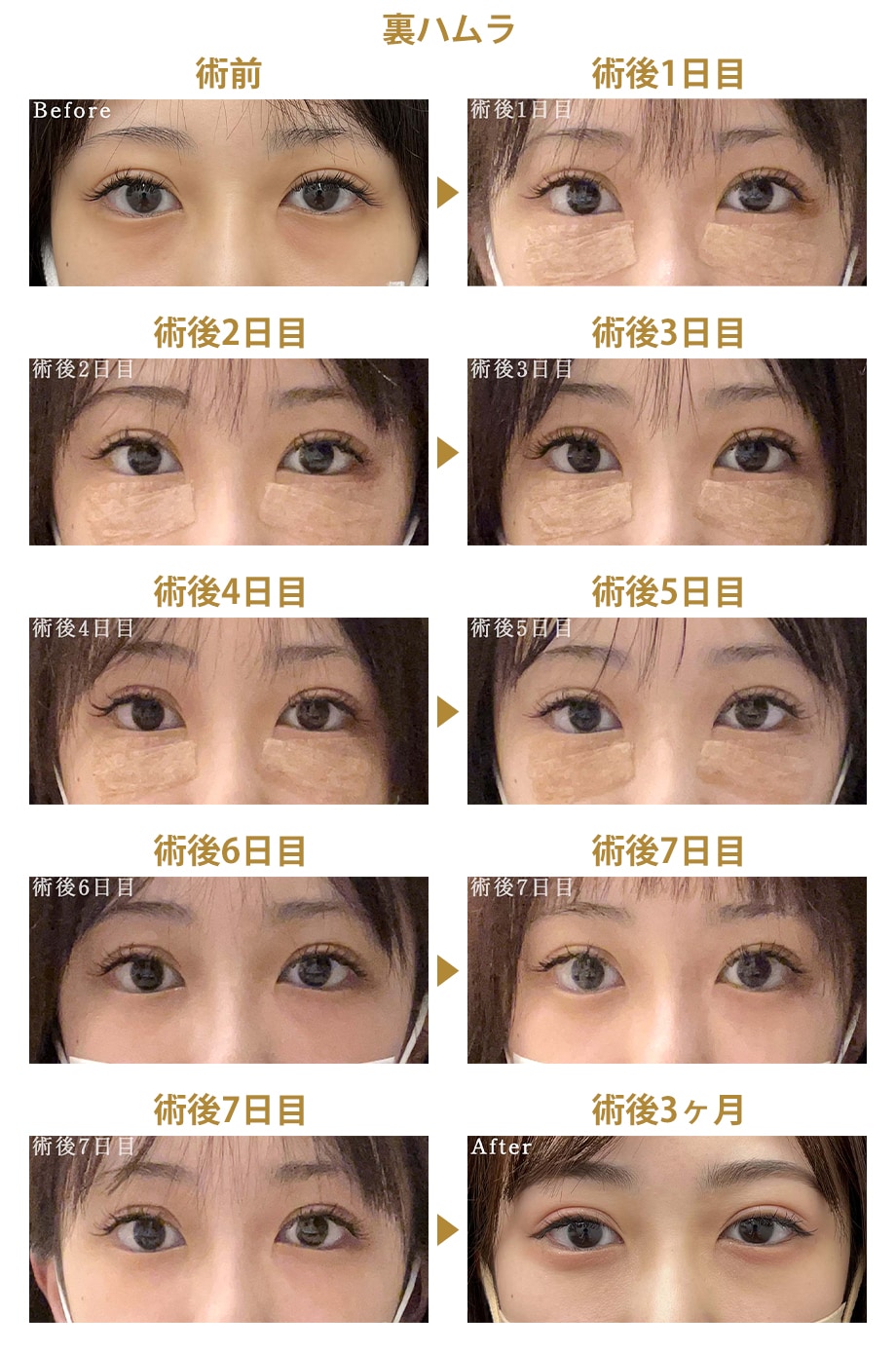 ピックアップ症例写真