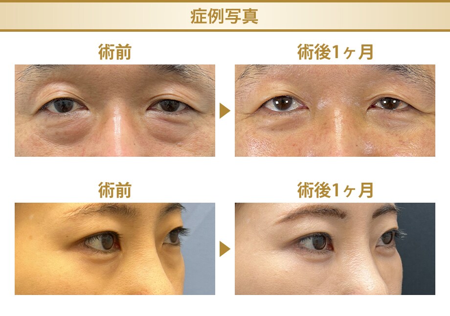 料金下症例写真