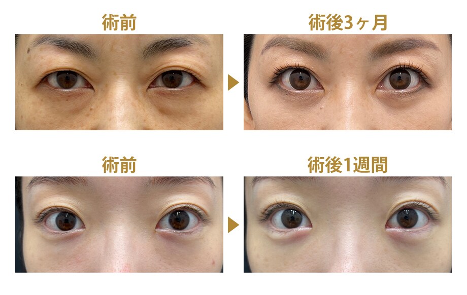 ピックアップ症例写真