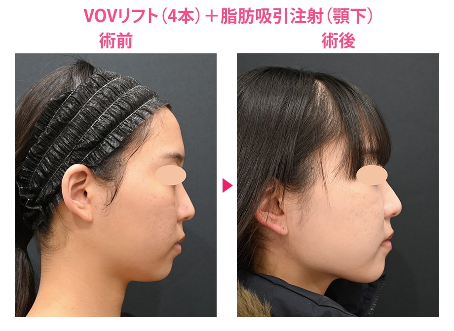 ピックアップ症例写真