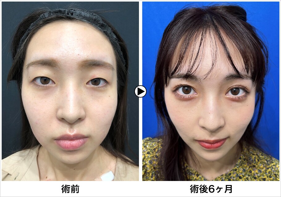 メイン下症例写真
