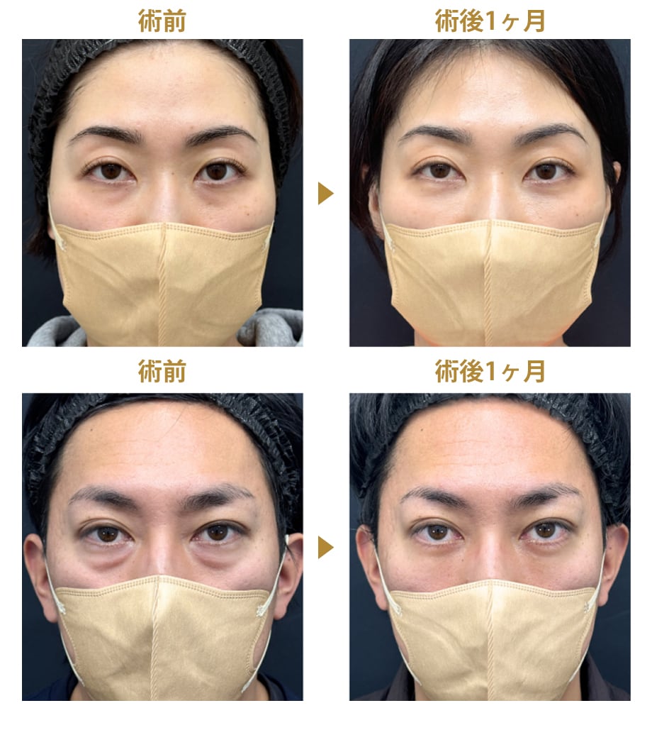 ピックアップ症例写真