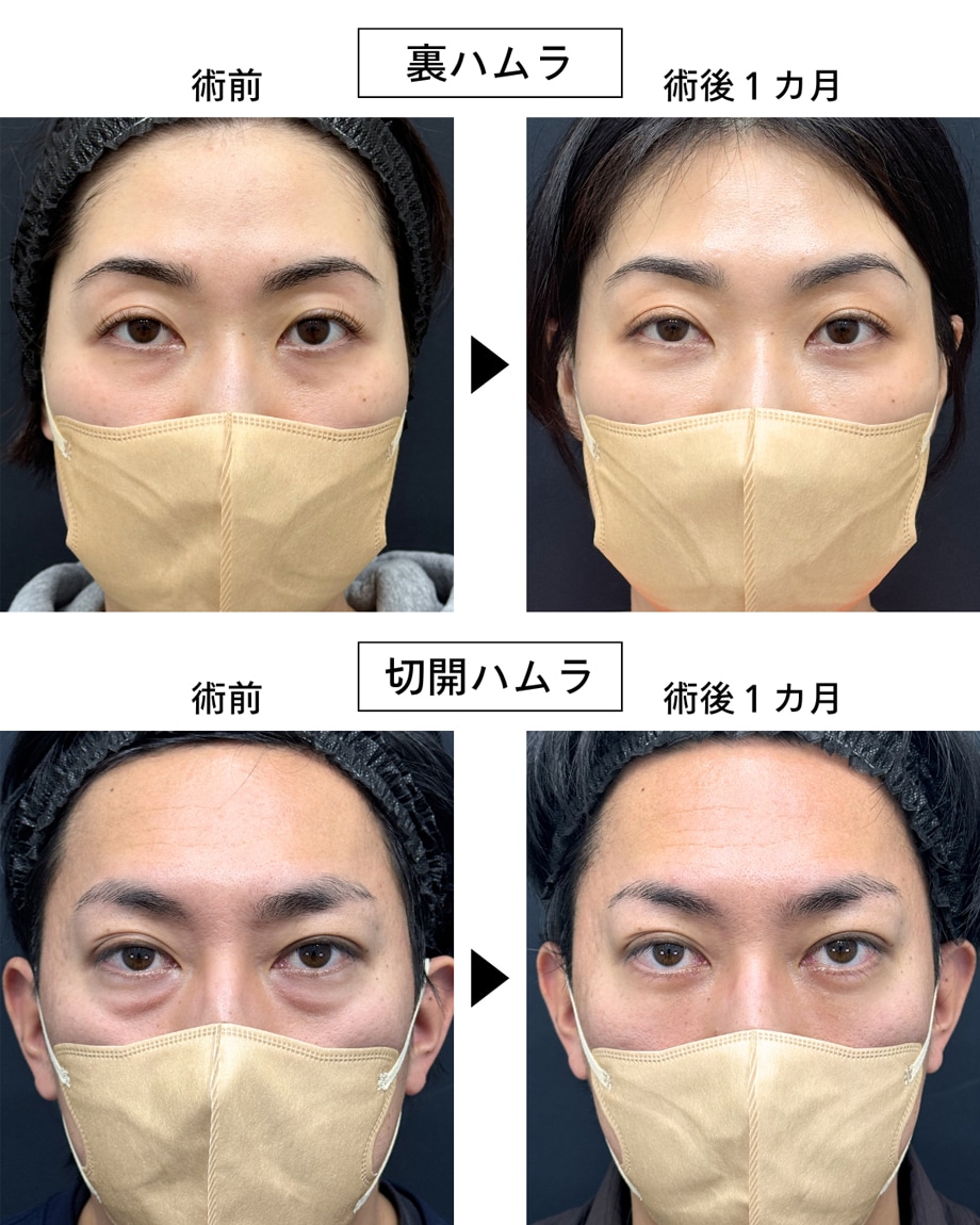 ピックアップ症例写真