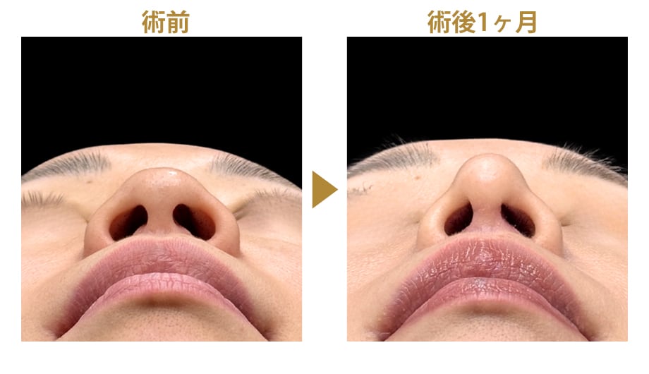 ピックアップ症例写真