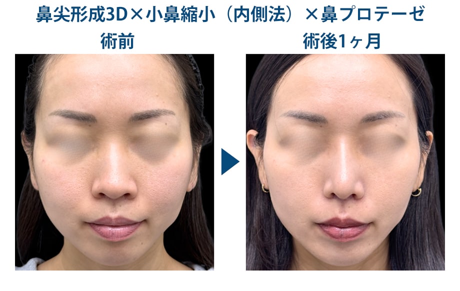 ピックアップ症例写真