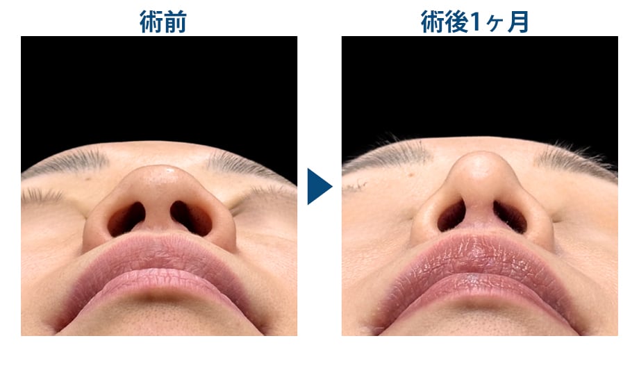 ピックアップ症例写真