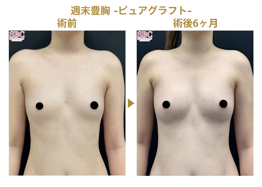 ピックアップ症例写真