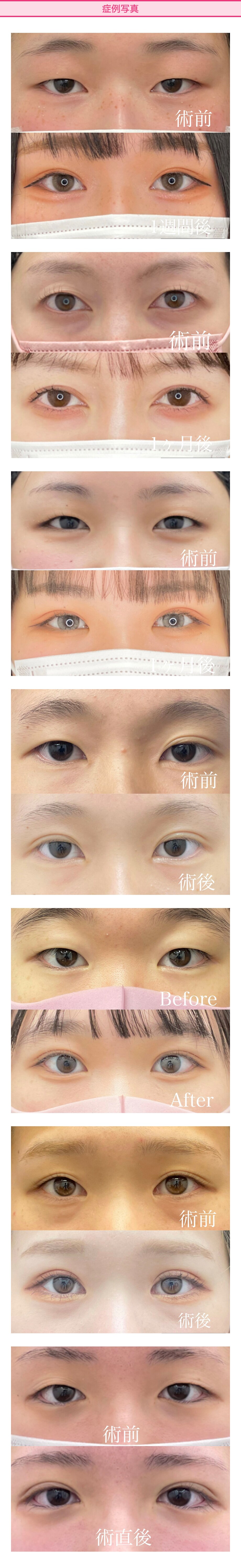 症例写真
