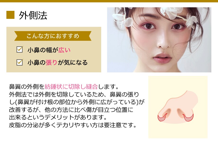 北海道 藤巻医師 鼻 美容外科学会認定 鼻整形モニター募集 美容整形 美容外科の湘南美容クリニック