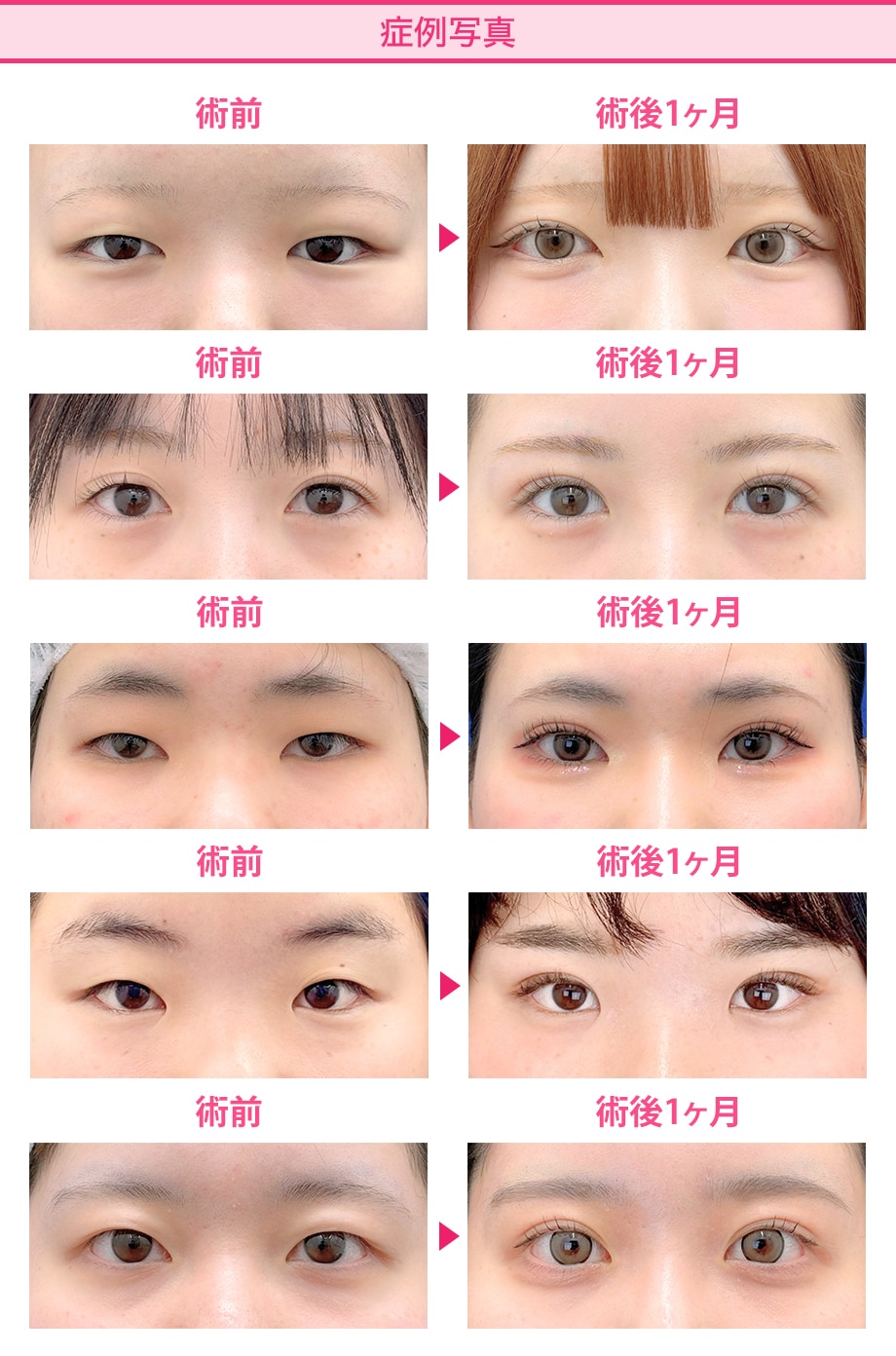 料金下症例写真