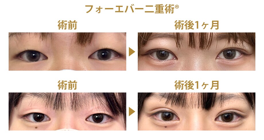 ピックアップ症例写真