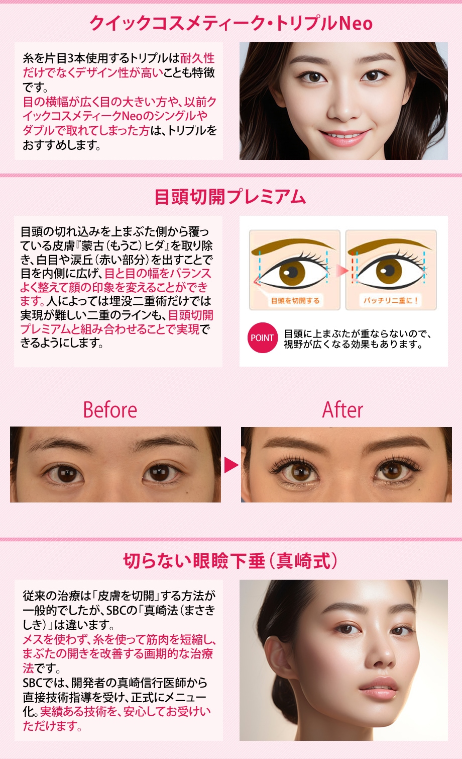 施術解説小カテ