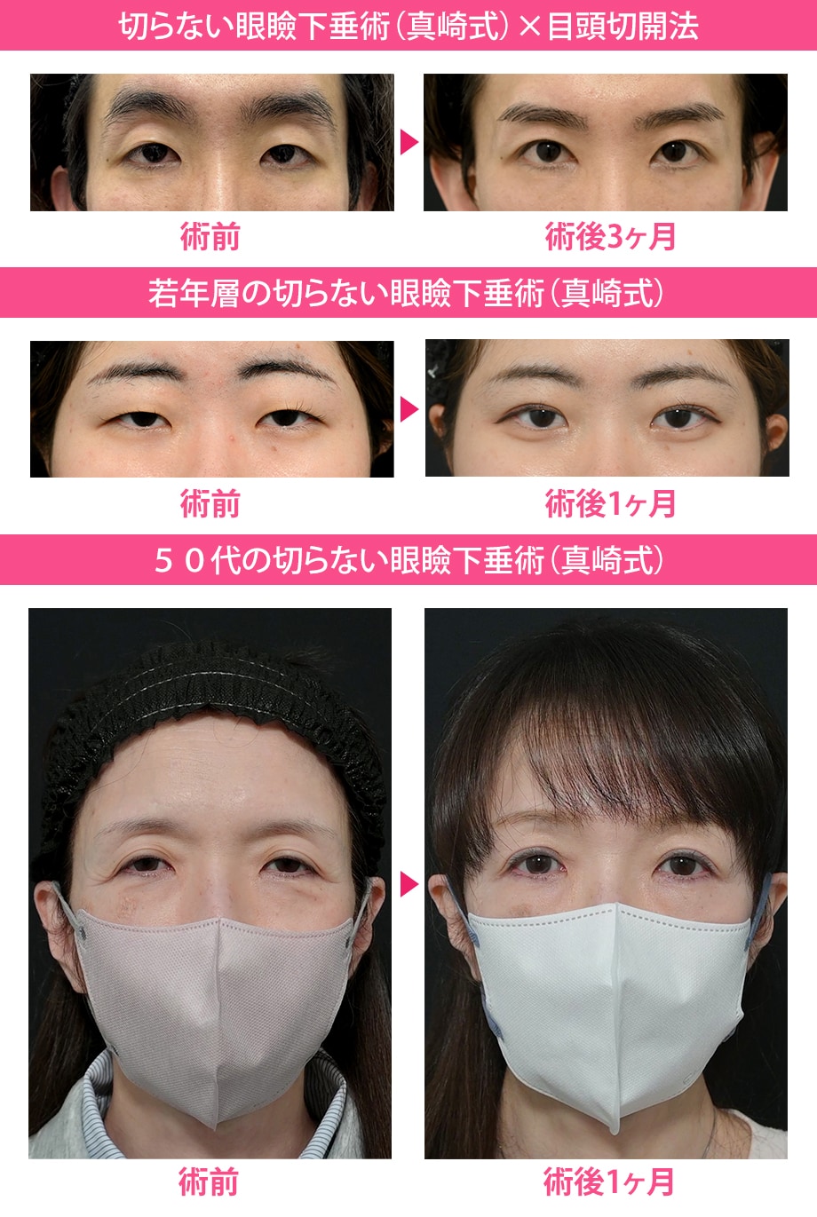 施術解説小カテ