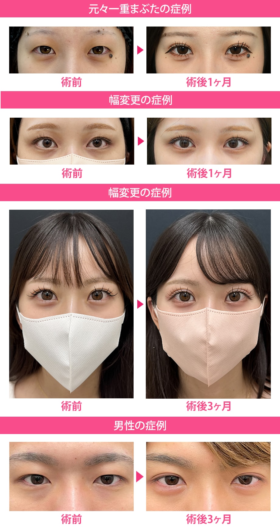 ピックアップ症例写真
