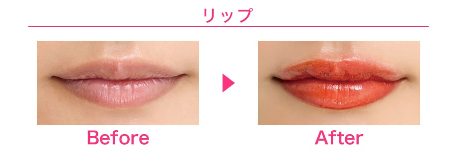 ピックアップ症例写真