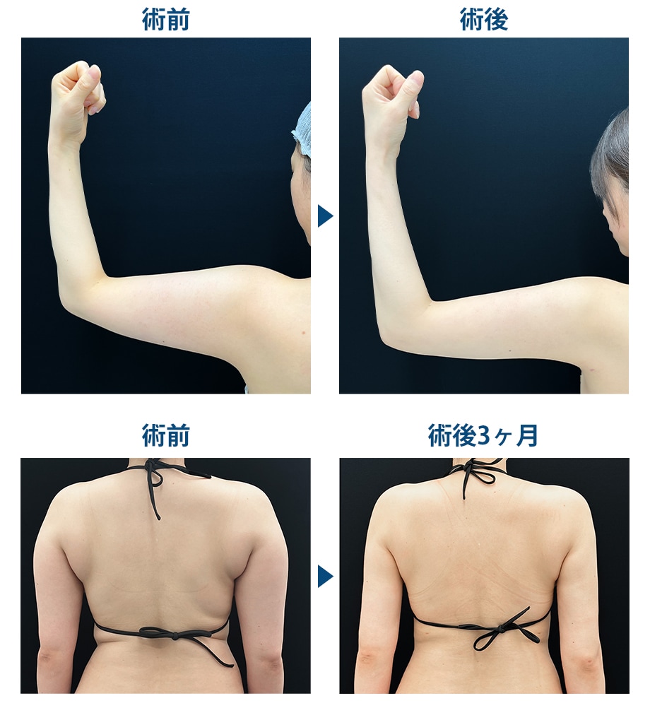 ピックアップ症例写真