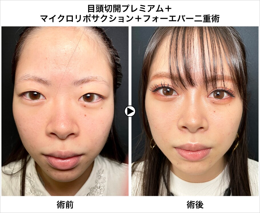 メイン下症例写真