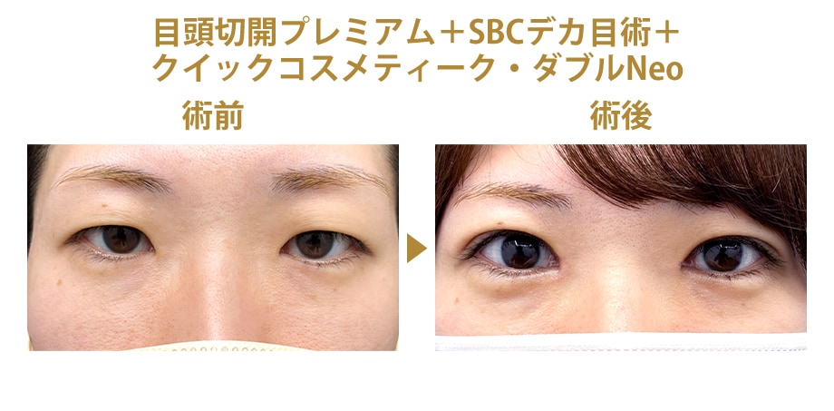 ピックアップ症例写真