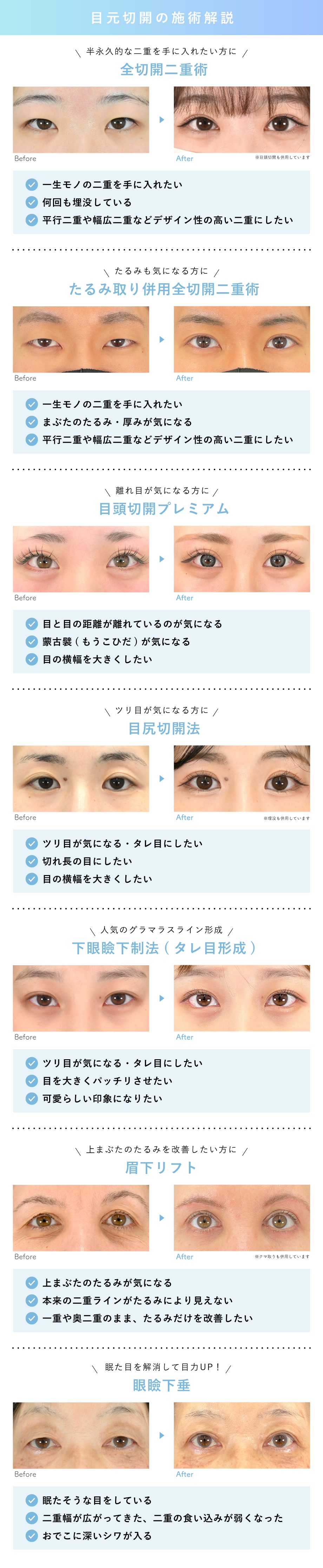 症例