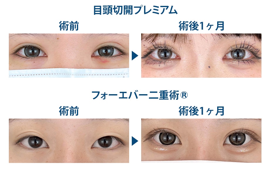 ピックアップ症例写真