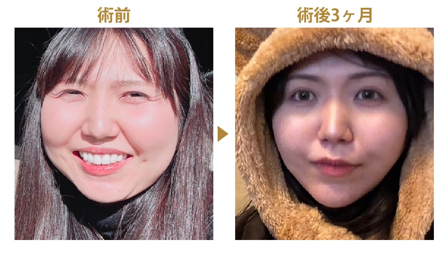 ピックアップ症例写真