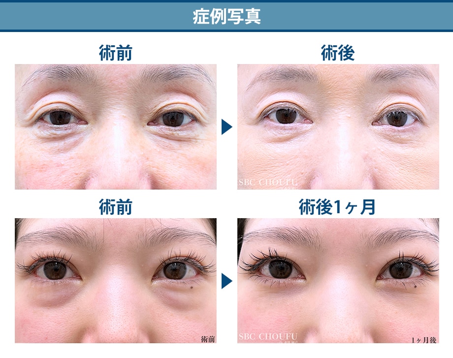 料金下症例写真